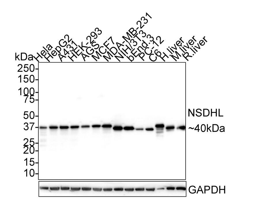 NSDHL Antibody (PSH02-36)