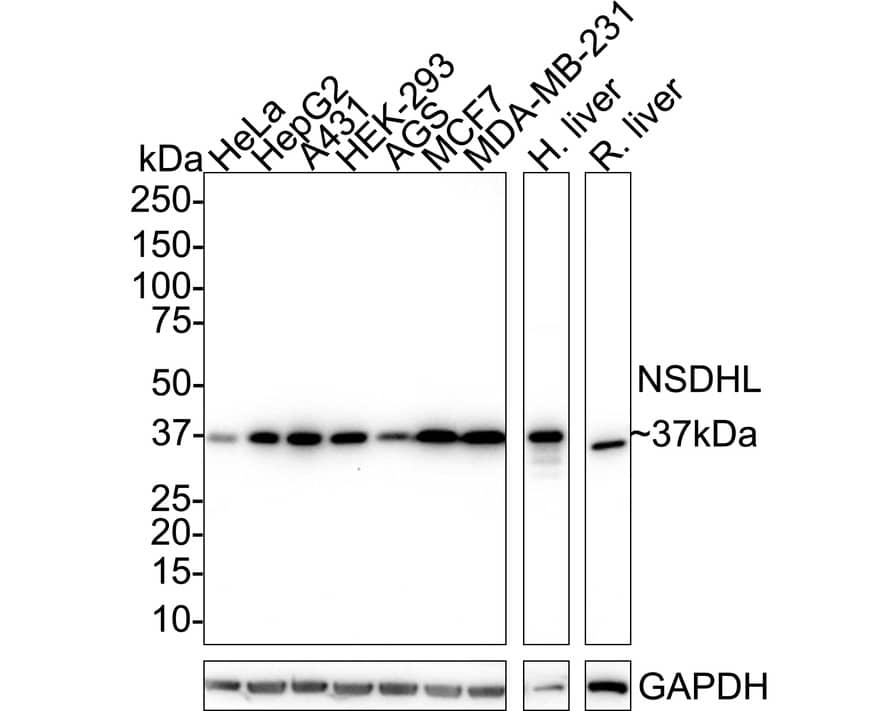 NSDHL Antibody (PSH02-37) Western Blot: NSDHL Antibody (PSH02-37) [NBP3-32664]