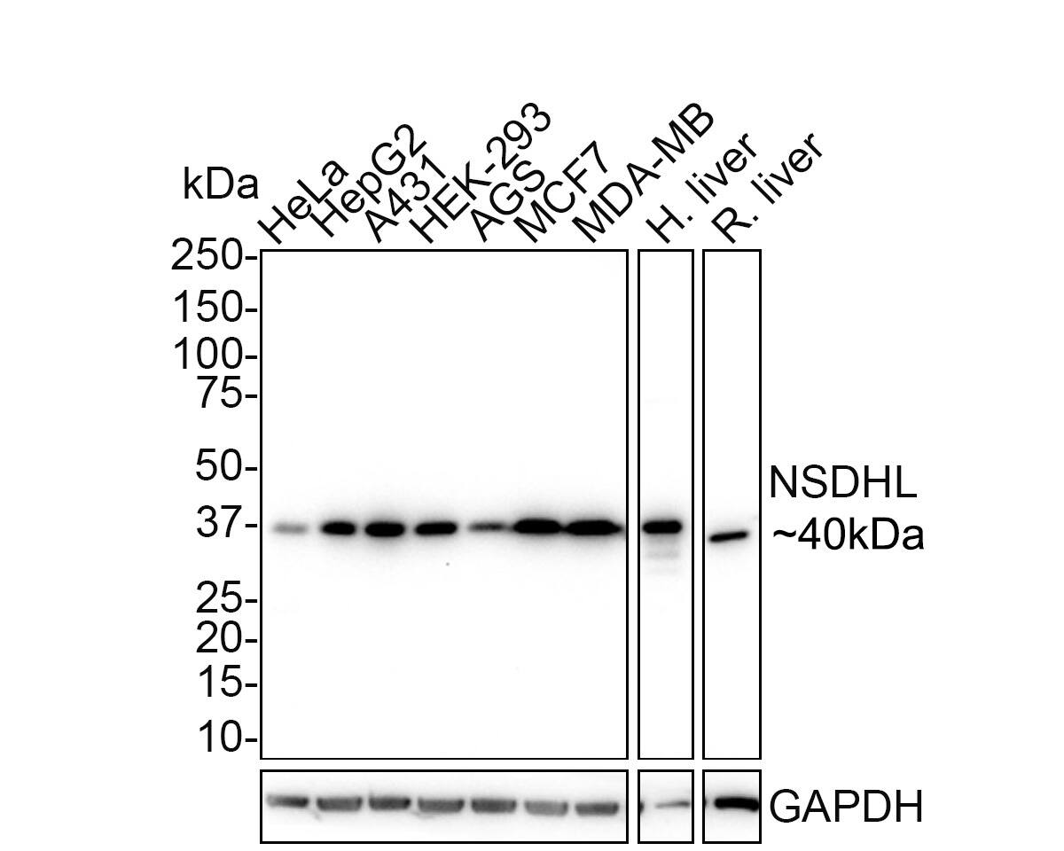 NSDHL Antibody (PSH02-37)