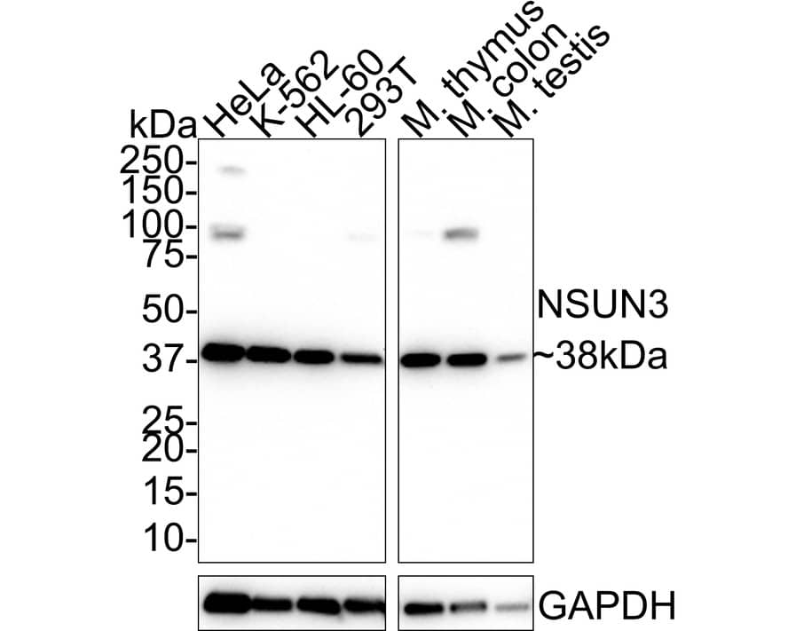 NSUN3 Antibody (PSH01-97)