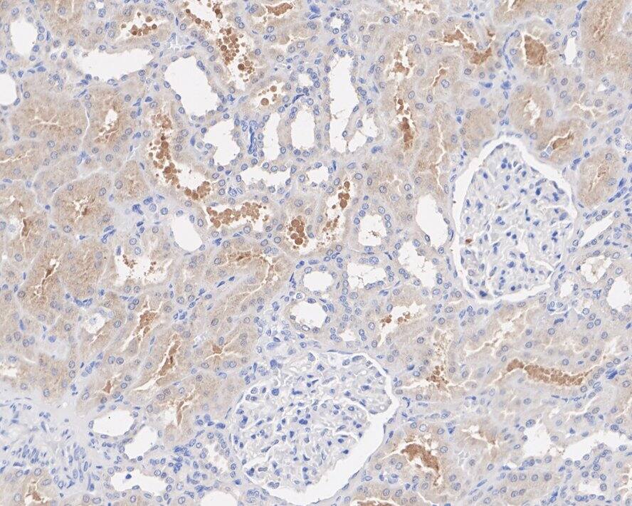 NSUN3 Antibody (PSH01-97)