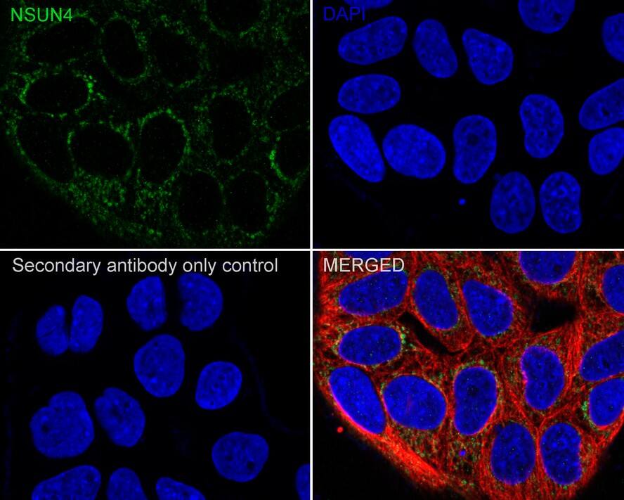 NSUN4 Antibody (4G3-R)