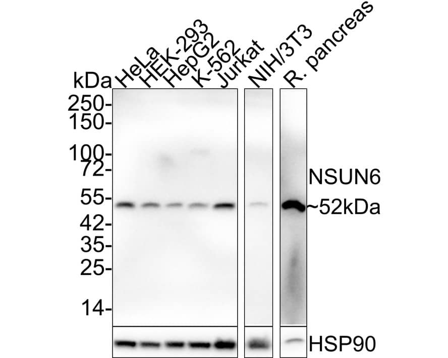 NSUN6 Antibody (PSH02-80) Western Blot: NSUN6 Antibody (PSH02-80) [NBP3-32667]