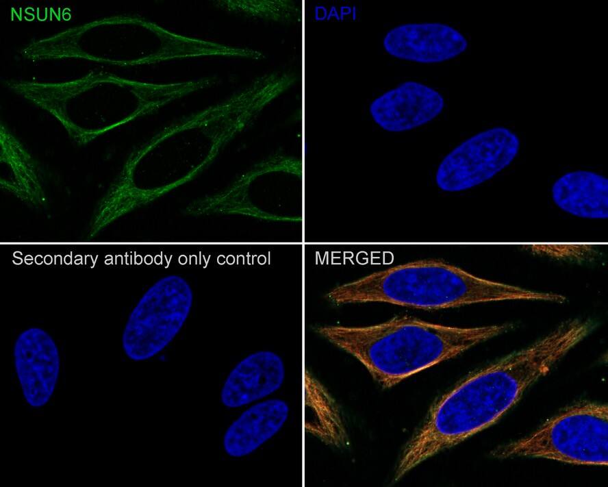 NSUN6 Antibody (PSH02-80)