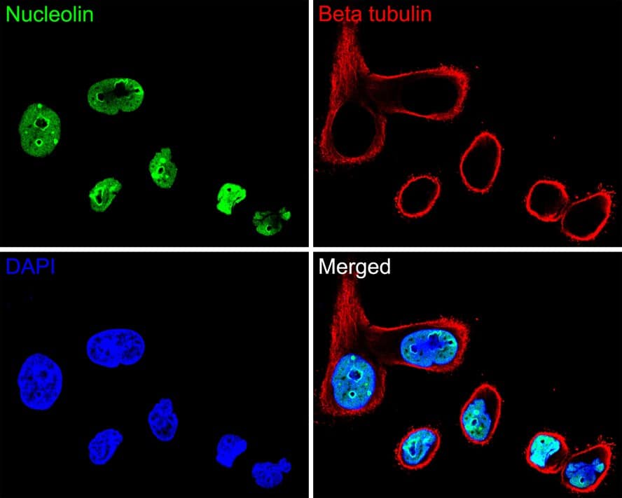 Nucleolin Antibody (JE65-71)