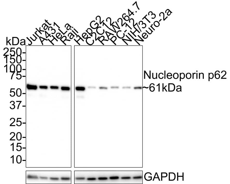 NUP62 Antibody (JE55-09) Western Blot: NUP62 Antibody (JE55-09) [NBP3-32670]