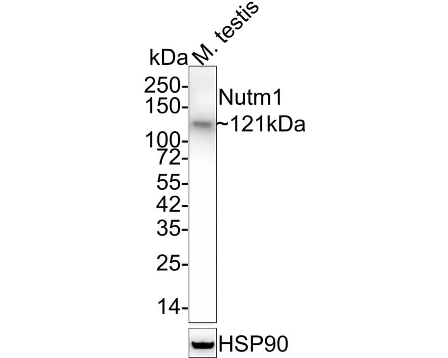 NUT Antibody