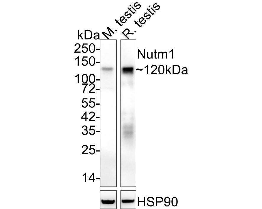 NUT Antibody (PSH02-78) Western Blot: NUT Antibody (PSH02-78) [NBP3-32673]