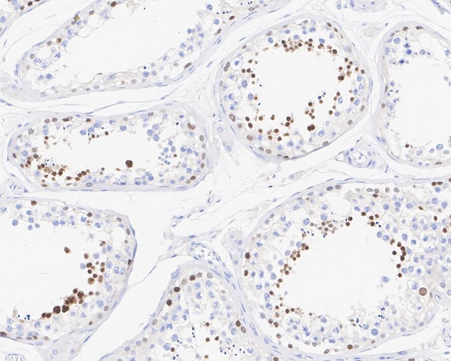 NUT Antibody (PSH02-78)
