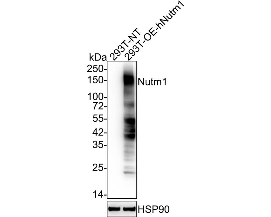 NUT Antibody (PSH03-36)