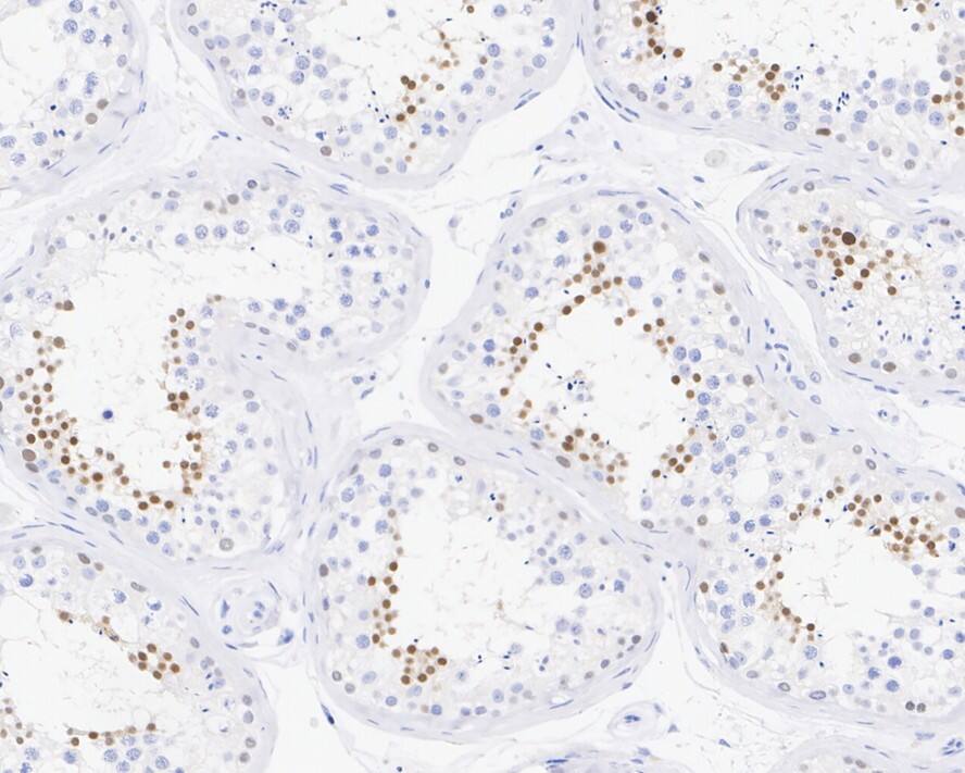 NUT Antibody (PSH03-36)