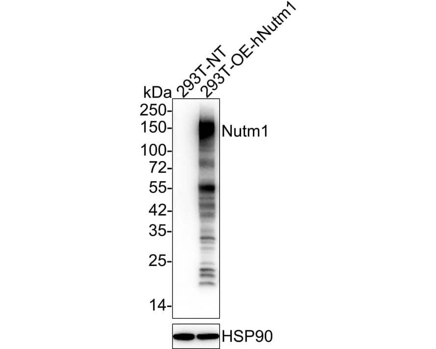 NUT Antibody (PSH03-37)