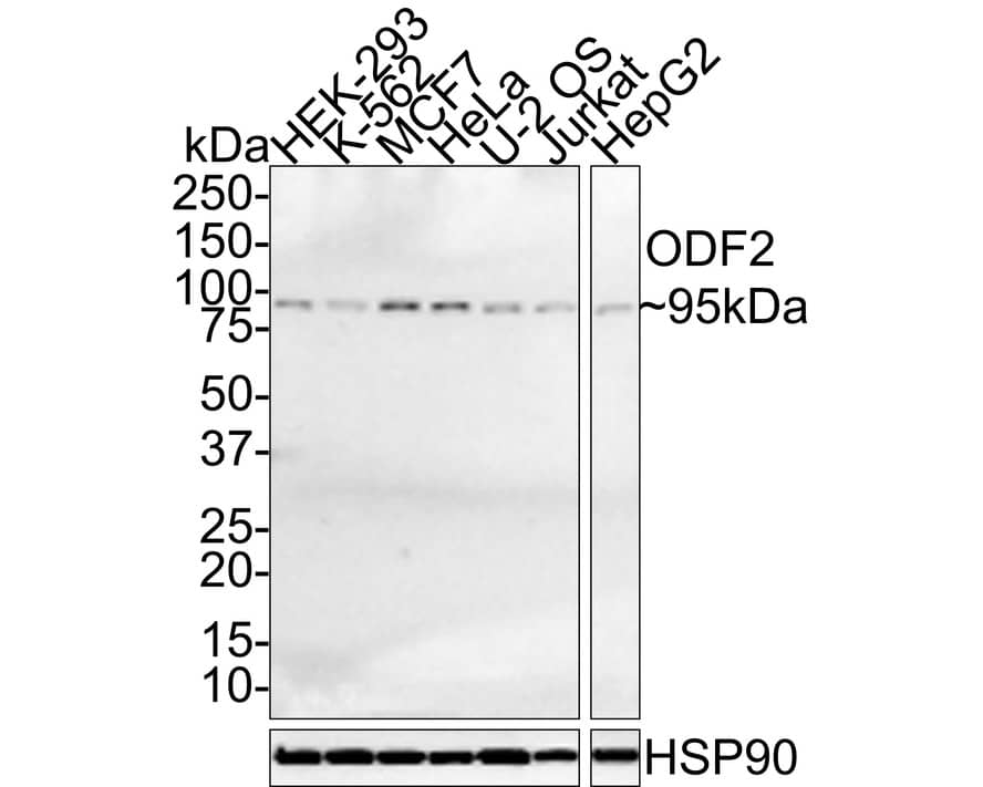 ODF2 Antibody (JE35-01)