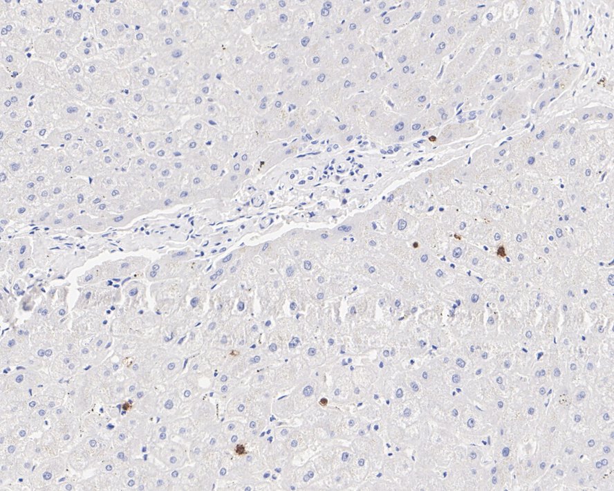 OLFM4 Antibody (PSH01-36)