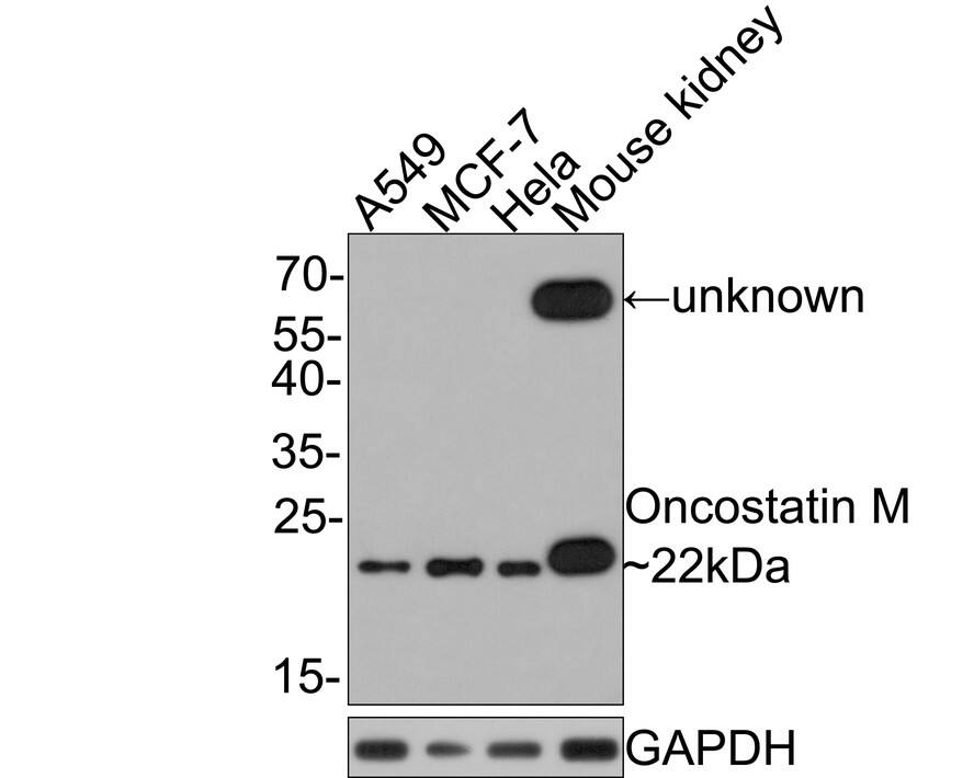 Oncostatin M/OSM Antibody (JE40-04) Western Blot: Oncostatin M/OSM Antibody (JE40-04) [NBP3-32679]