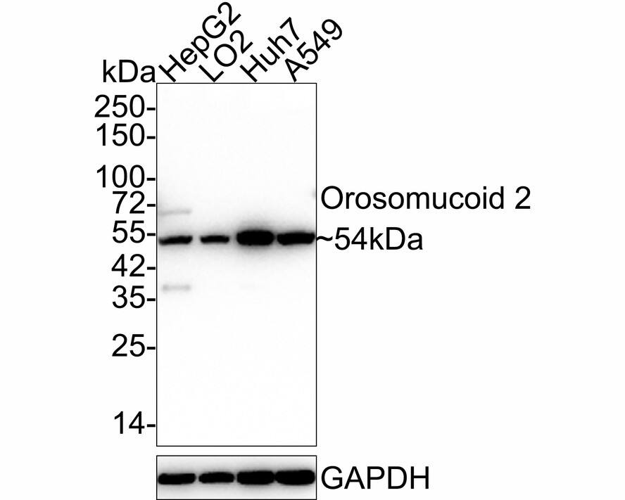 Orosomucoid 2 Antibody