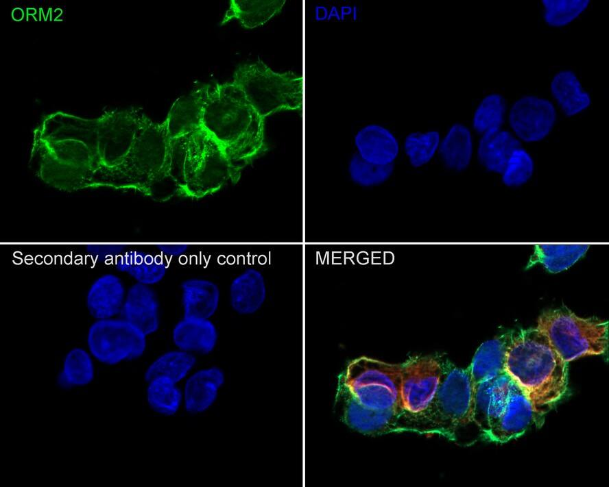 Orosomucoid 2 Antibody