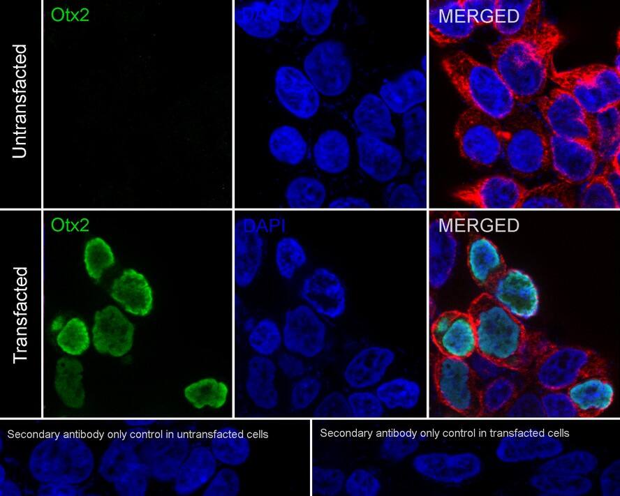 Otx1 Antibody (PSH01-62)