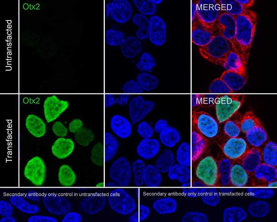 Otx2 Antibody (PSH01-61)