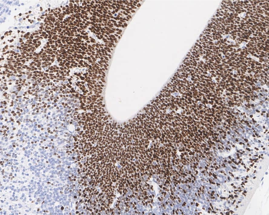 Otx2 Antibody (PSH01-61)