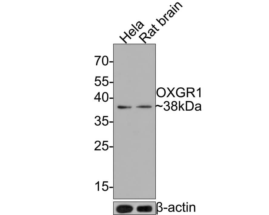 OXGR1/GPR80/P2Y15 Antibody (JE64-04)