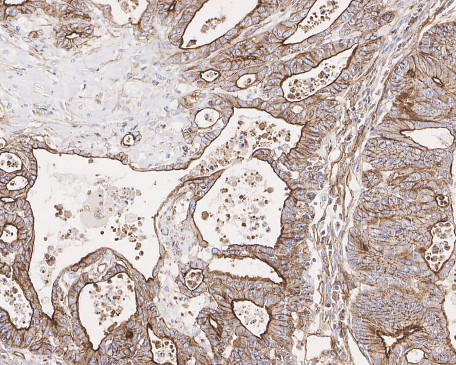 MDR1/ABCB1 Antibody (A10E12-R)