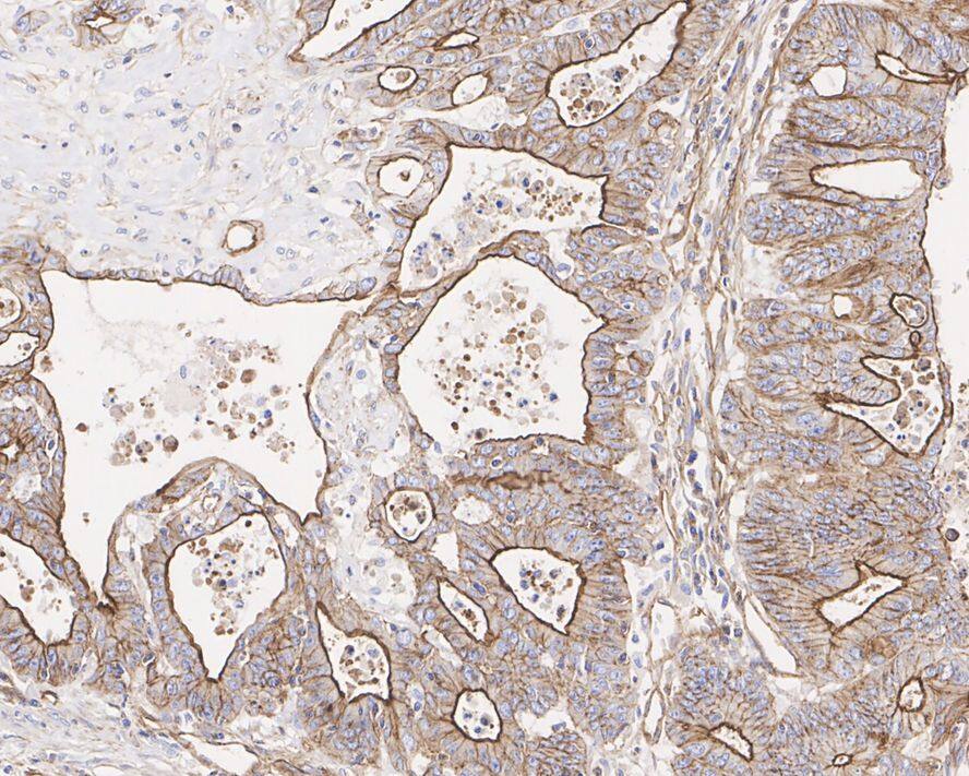 MDR1/ABCB1 Antibody (A10F1-R)