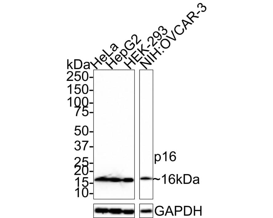 p16INK4a/CDKN2A Antibody (PD01-16)