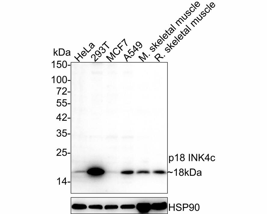 p18INK4c/CDKN2C Antibody (JE36-09)