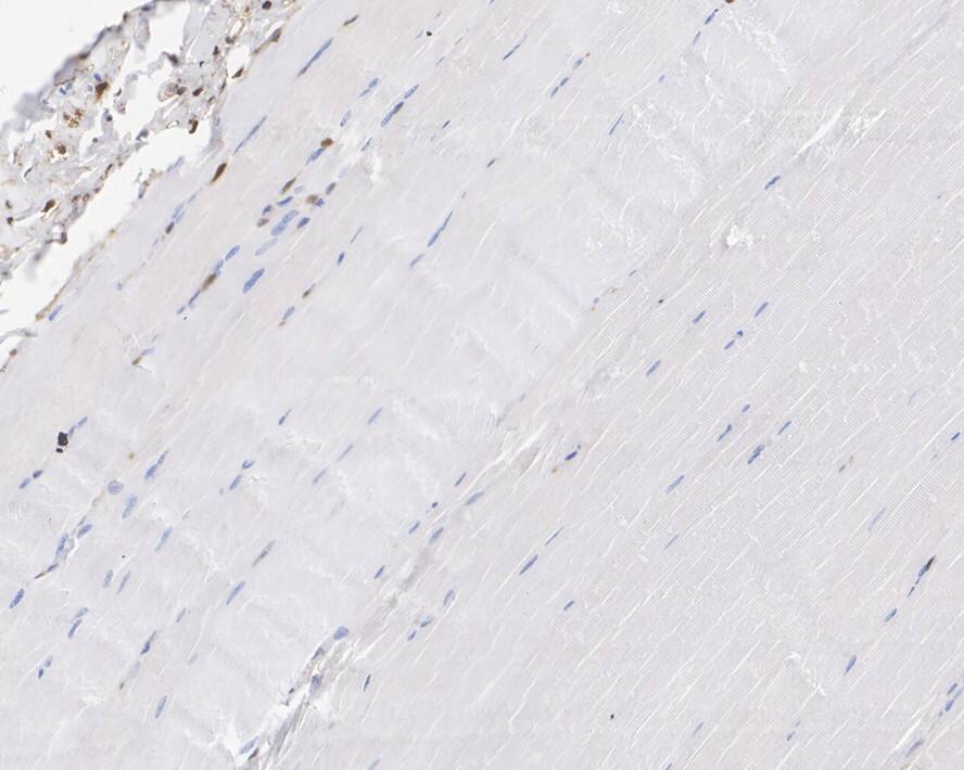 p18INK4c/CDKN2C Antibody (JE36-09)