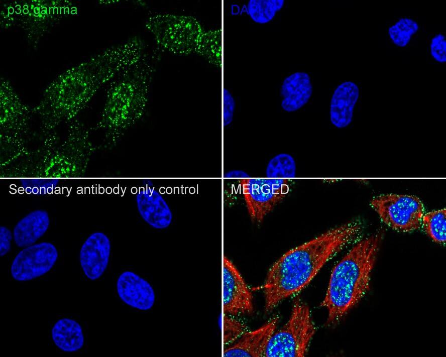 p38 gamma/SAPK3 Antibody (PSH03-58)