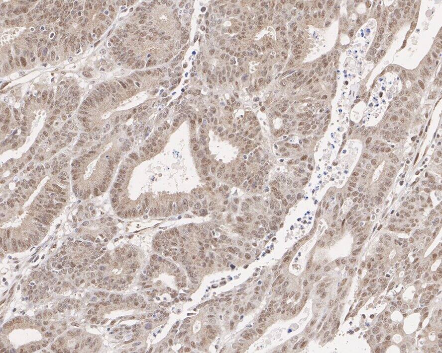 p38 gamma/SAPK3 Antibody (PSH03-58)