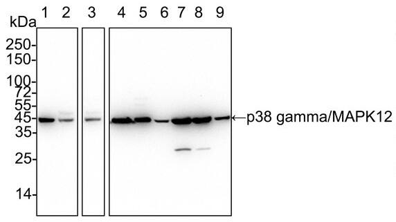 p38 gamma/SAPK3 Antibody (PSH03-58)