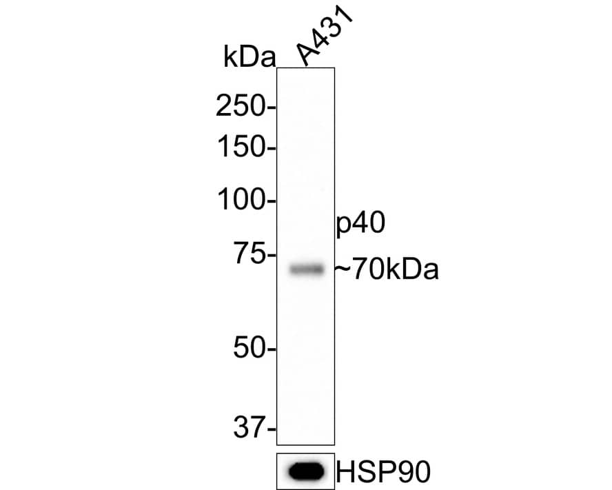 p40/deltaNp63 Antibody (PDH0-02)