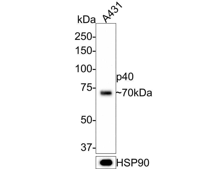 p40/deltaNp63 Antibody (PDH0-06)