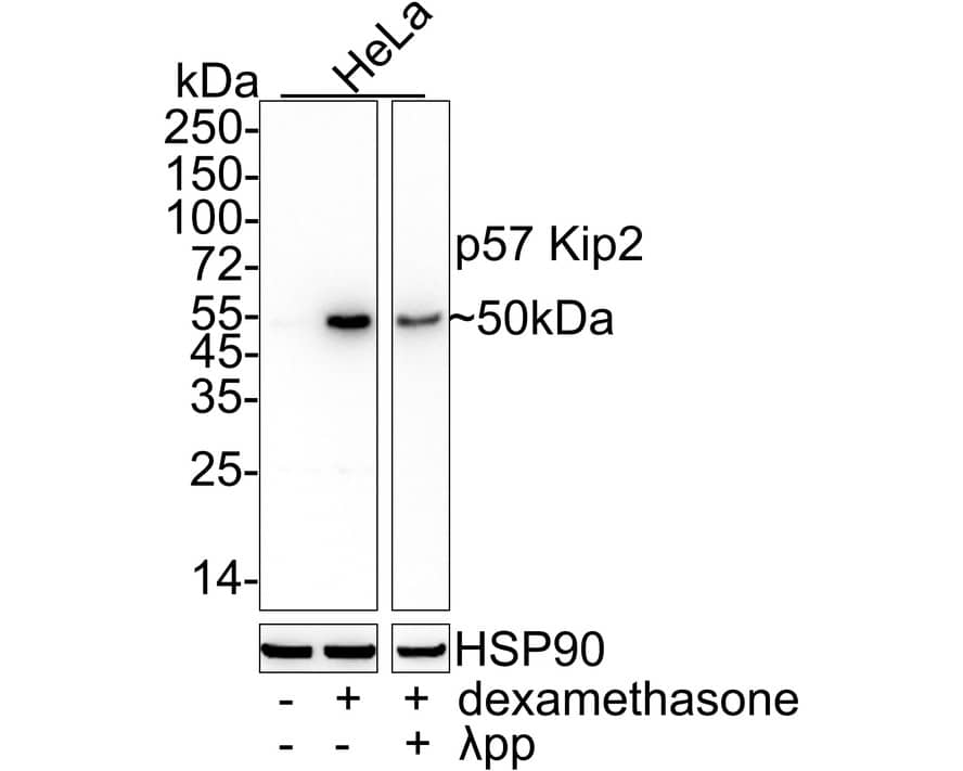 p57 Kip2 Antibody (JE02-08)