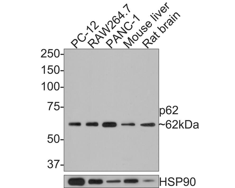 p62/SQSTM1 Antibody (PS00-61)