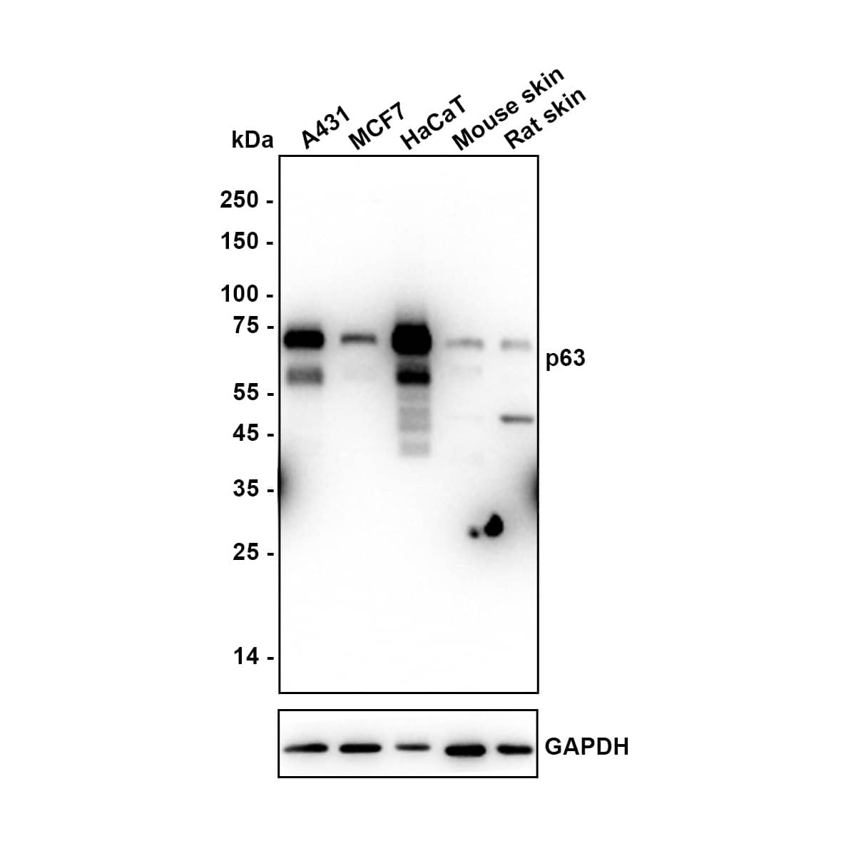 p63/TP73L Antibody (SC06-31) Western Blot: p63/TP73L Antibody (SC06-31) [NBP3-32703]