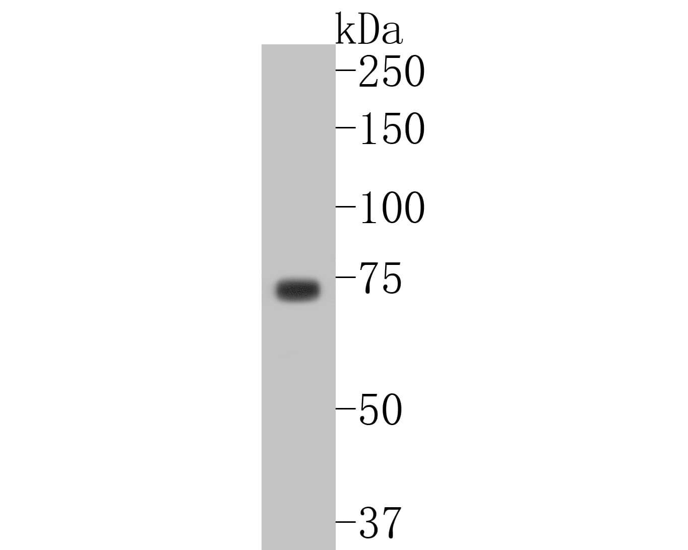 p63/TP73L Antibody (SC06-31)