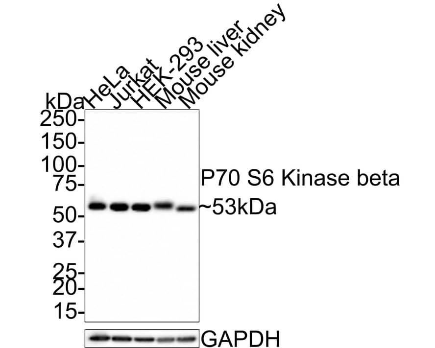 p70 S6 Kinase beta/S6K2 Antibody (JE35-69)