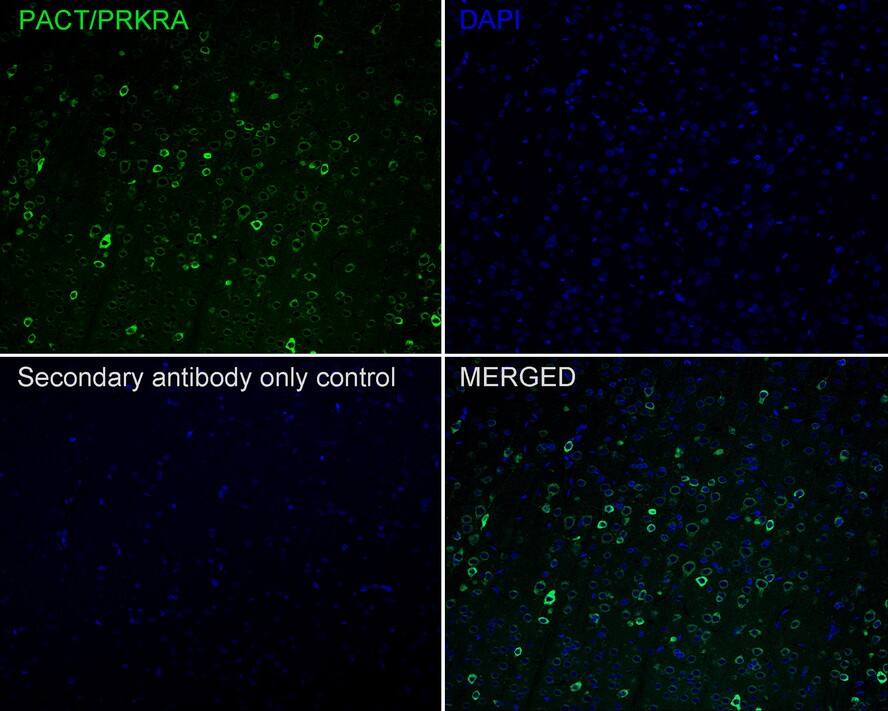 PACT Antibody (PSH02-14)