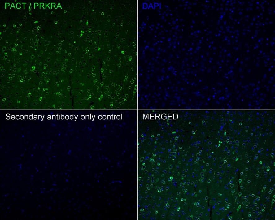PACT Antibody (PSH02-15)