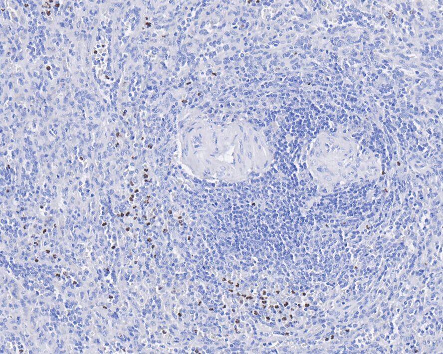 PADI4 Antibody (PSH01-33)