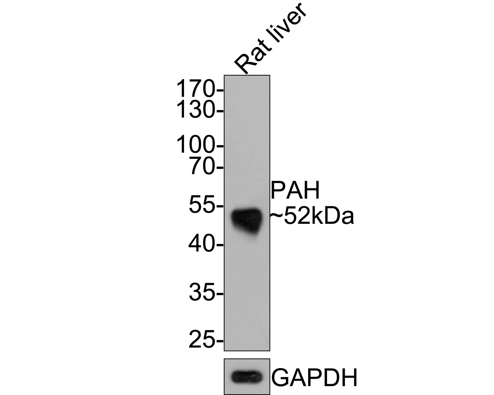 Phenylalanine Hydroxylase Antibody (JE64-47)