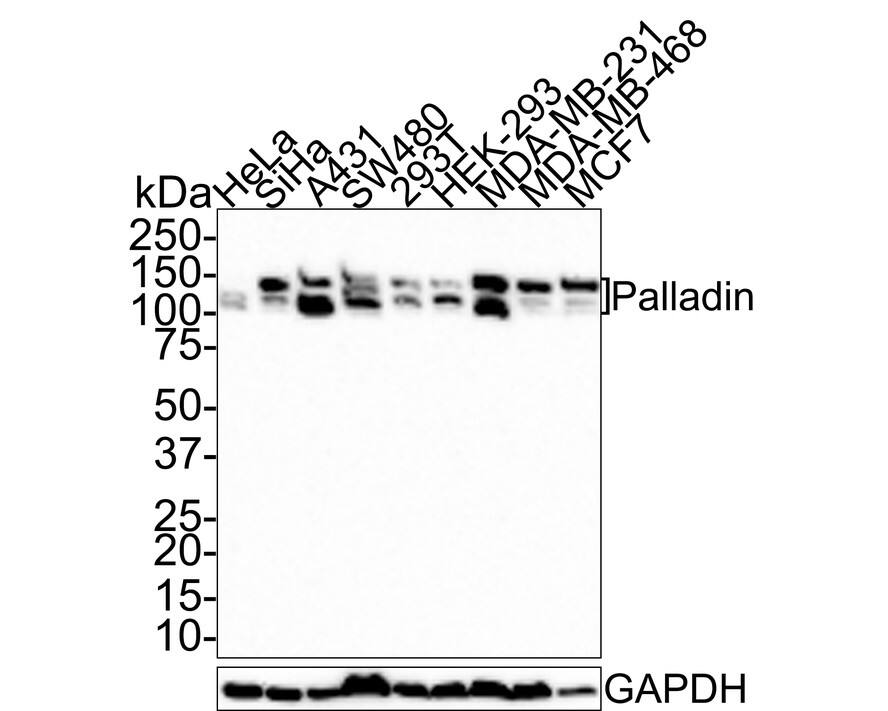 Palladin Antibody (JE66-56)