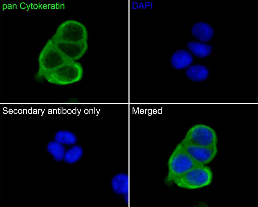 Cytokeratin, pan Antibody (PD00-15)