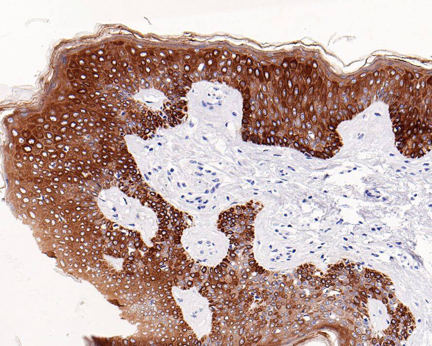 Cytokeratin, pan Antibody (PD00-15)
