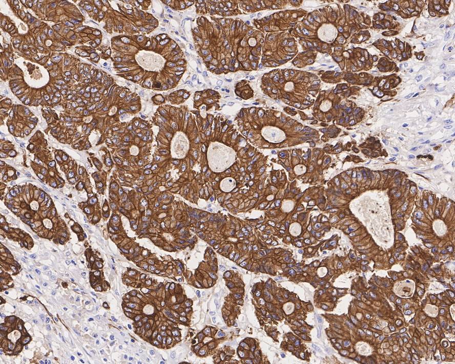 Cytokeratin, pan Antibody (PDH09-10)