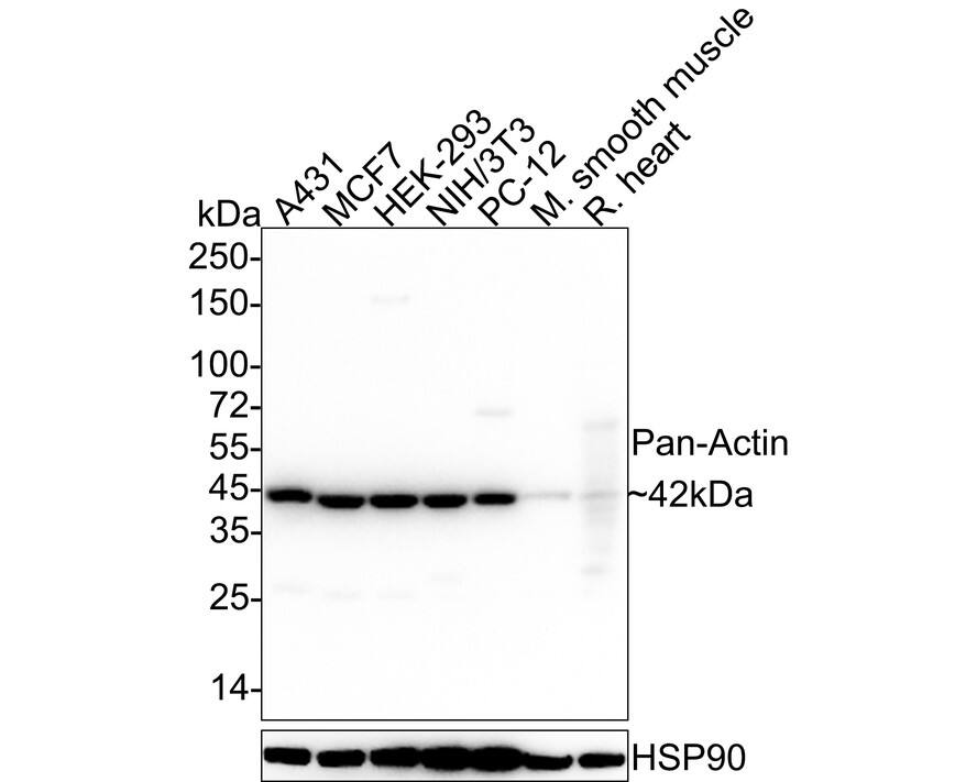 pan Actin Antibody (A2E1-R)