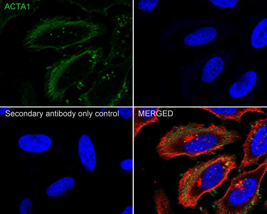 pan Actin Antibody (A2E1-R)